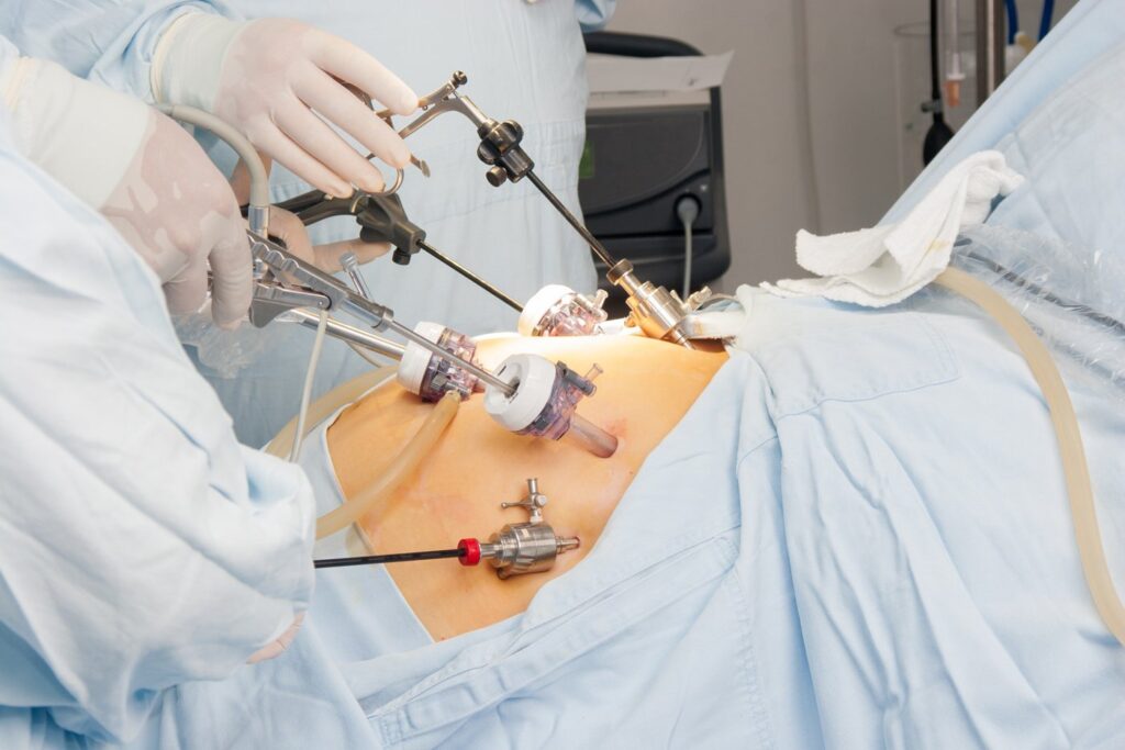 Bariatric surgeries vary in long-term benefits and risks