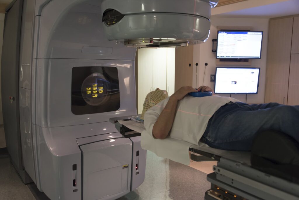External-beam radiation therapy underused for people with liver cancer awaiting transplant