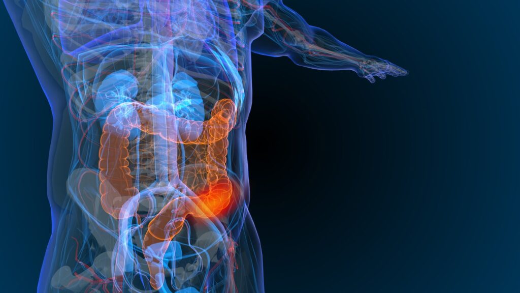 EU approves Qinlock for advanced gastrointestinal stromal tumor – Deciphera Pharma