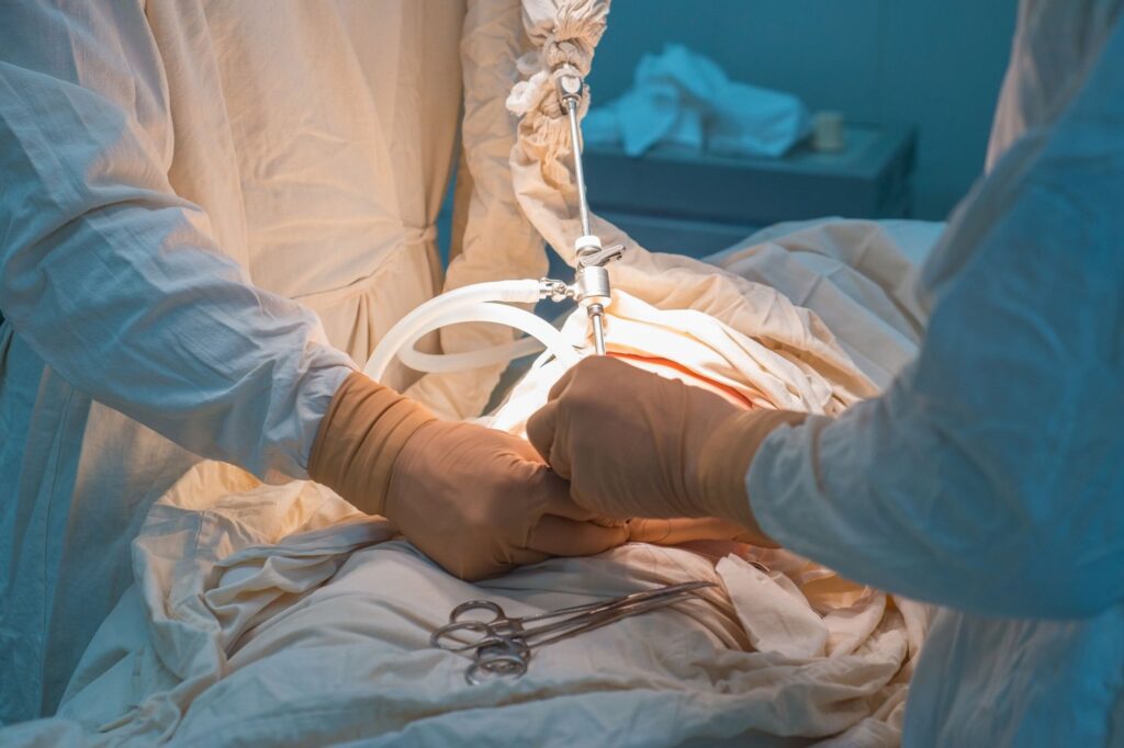 Bariatric surgery cuts cancer risks significantly