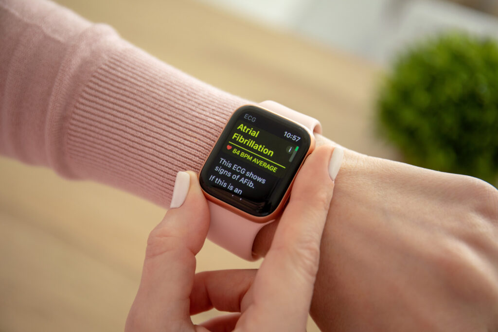 Are smartwatch health apps to detect atrial fibrillation smart enough?