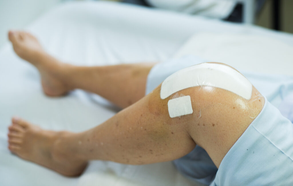 Study examines total knee replacement in patients under 21