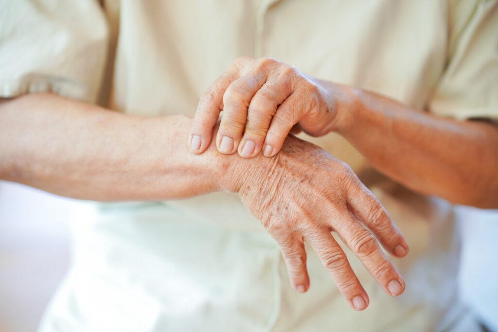 New drug offers hope for people with hand osteoarthritis