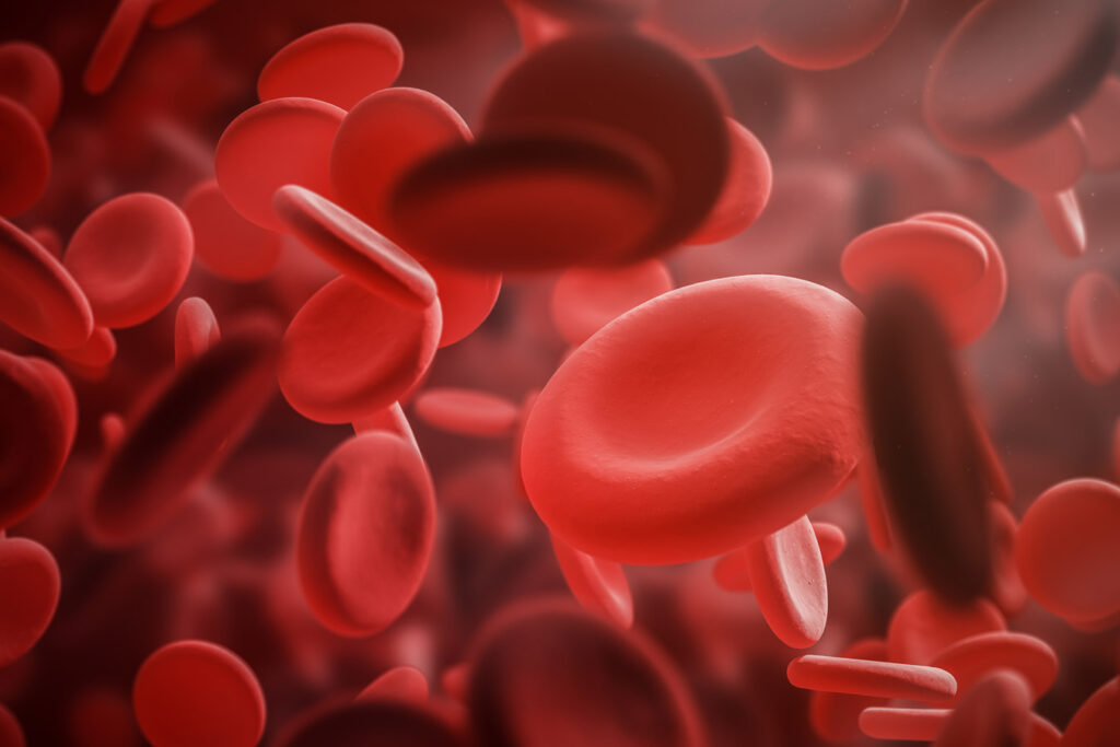Monthly injections of fitusiran reduces bleeds in patients with haemophilia A and B