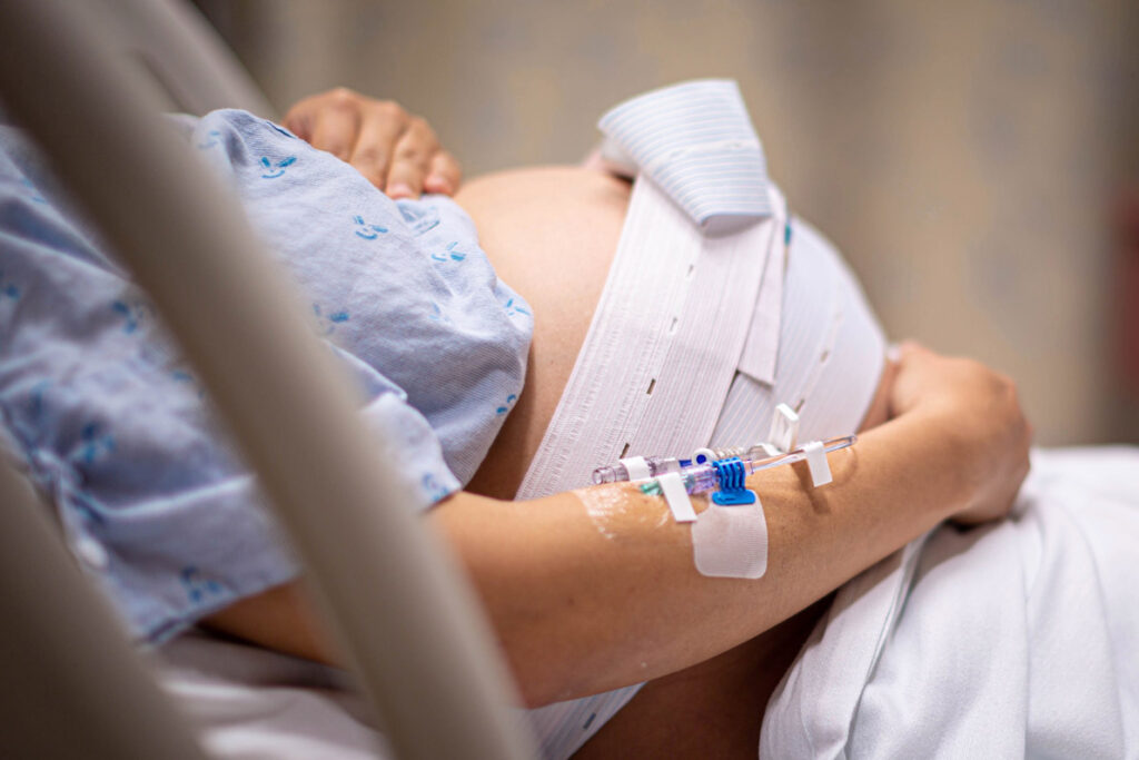 Rising rates of induced labor need to be reconsidered in the context of the UK maternity services staffing crisis, study suggests
