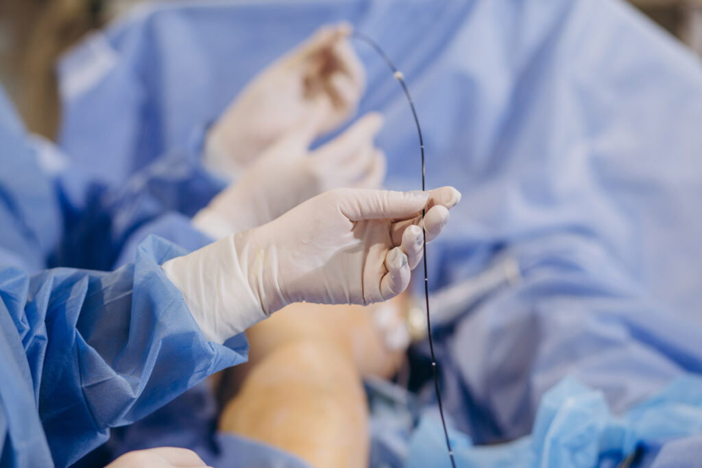 FDA approval for SurVeil drug-coated balloon for percutaneous transluminal angioplasty – Abbott