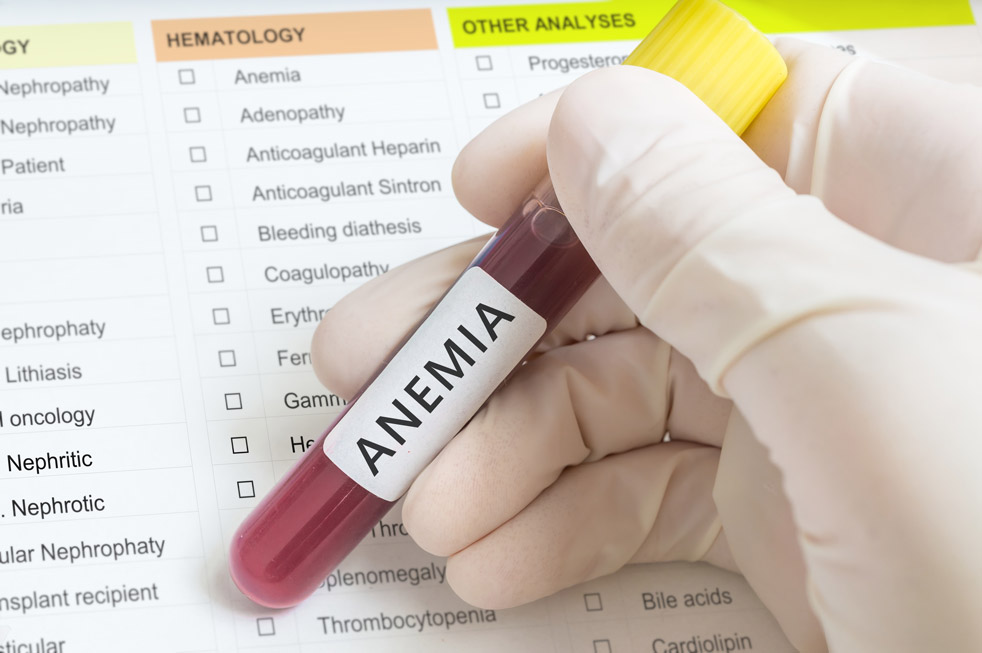 CHMP positive for Mircera to treat paediatric patients with anaemia associated with CKD – Roche